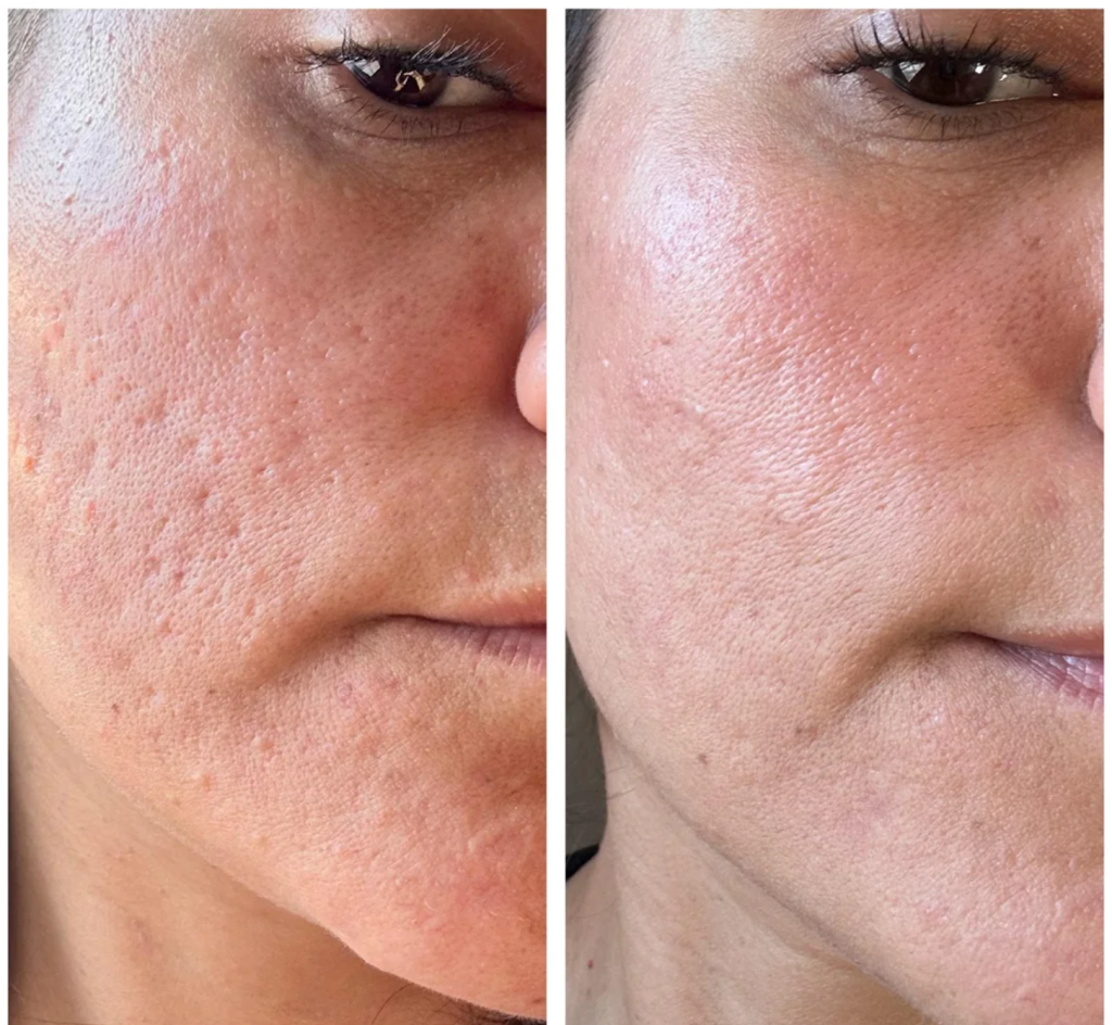 8 week update after 3 sessions————Source of information-buyer feedback